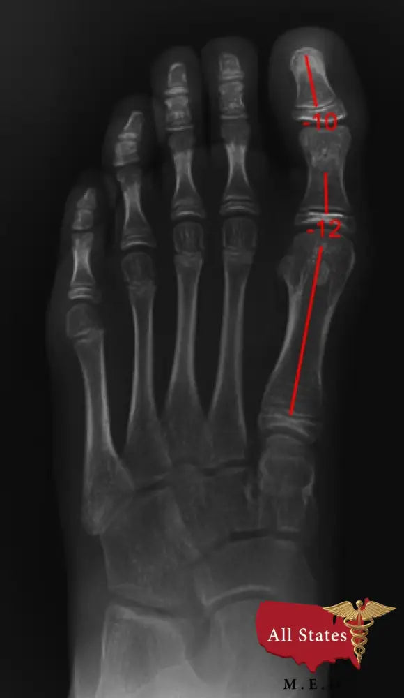 2020 Digital Plate Digital Podiatry Xray With Xcel Xray Platform