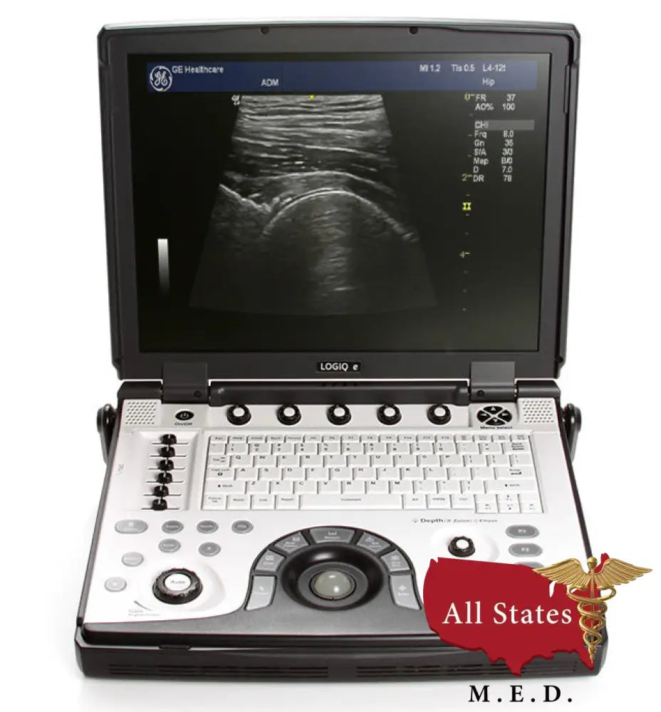 GE Logiq e R8 NEXTGEN Portable Ultrasound Machine NEW Open Box