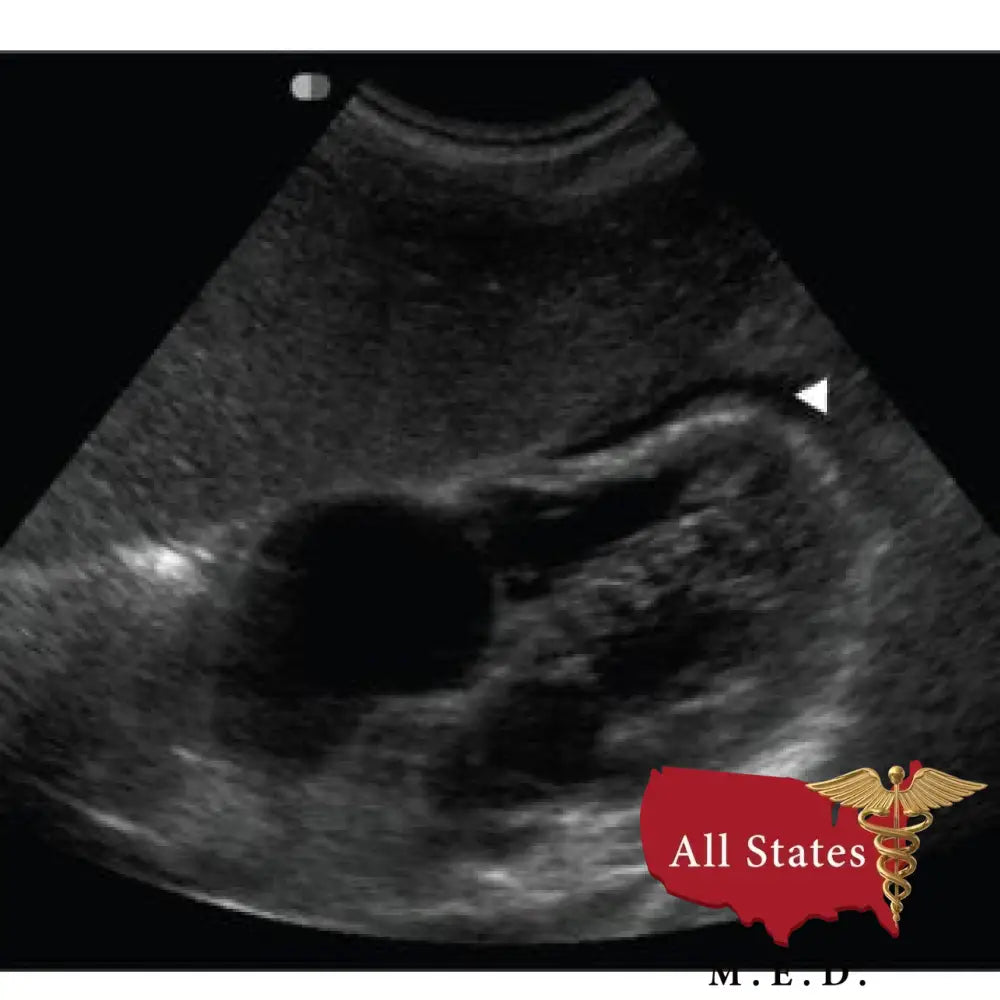 GE Vivid E9 XDClear Refurbished with 3 Probes