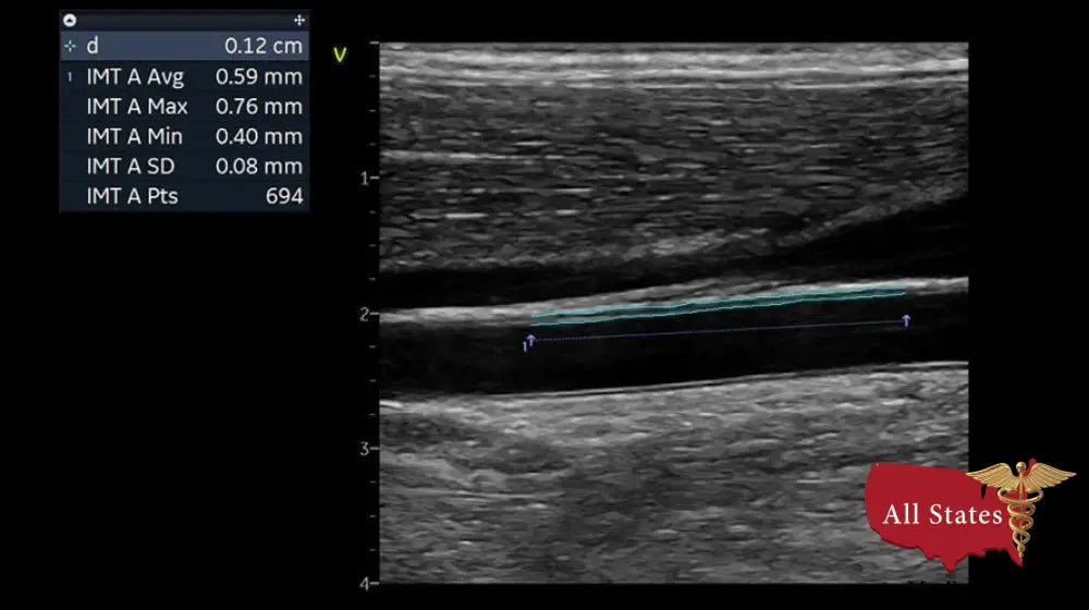GE Vivid IQ Ultra Edition v206 Portable Ultrasound