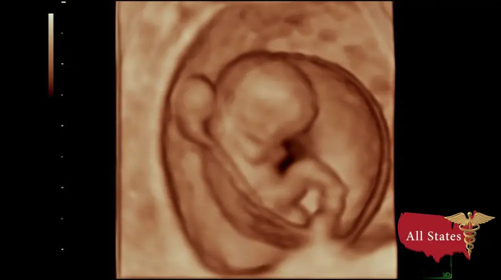 GE VOLUSON P8 BT22 Brand New