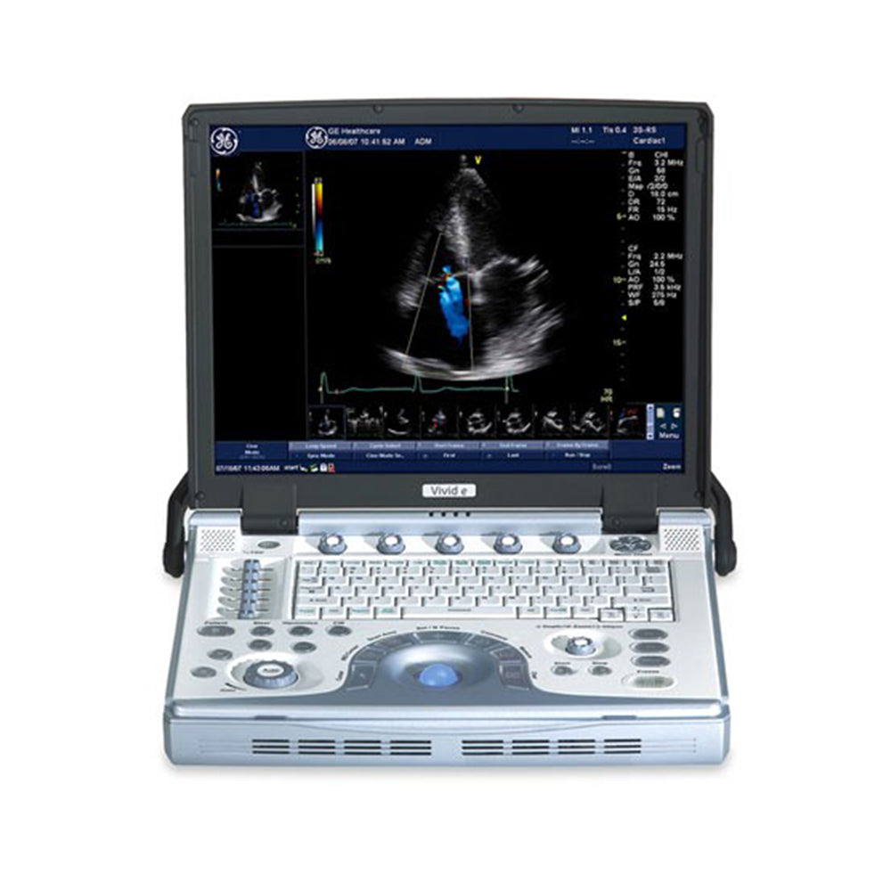 Refurbished GE VIVID e Compact Ultrasound System