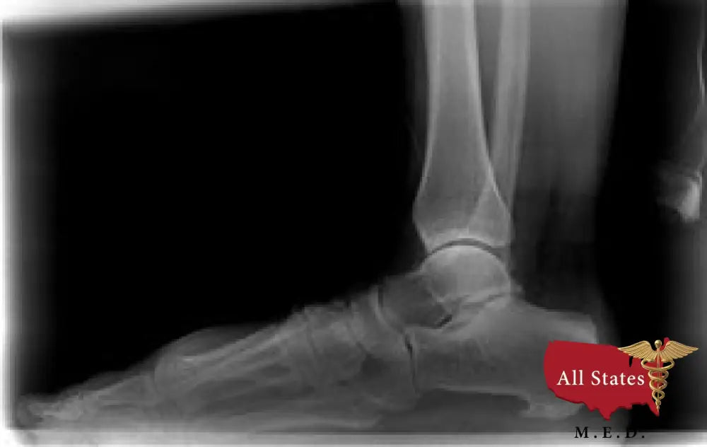 2020 Digital Plate Digital Podiatry Xray With Xcel Xray Platform