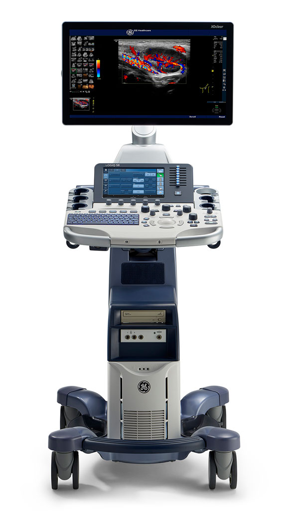 GE LOGIQ S8 XDclear 2.0 Ultrasound System