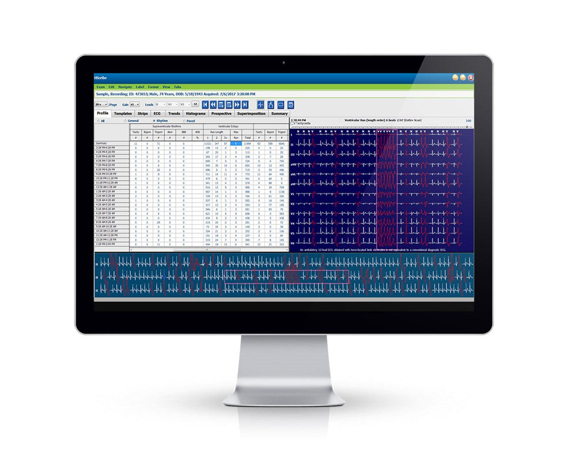 Hscribe Holter Analysis System, Version 6, w/ Adult & Pediatric Arrhythmia Analysis. XML Orders for HL7 Interface