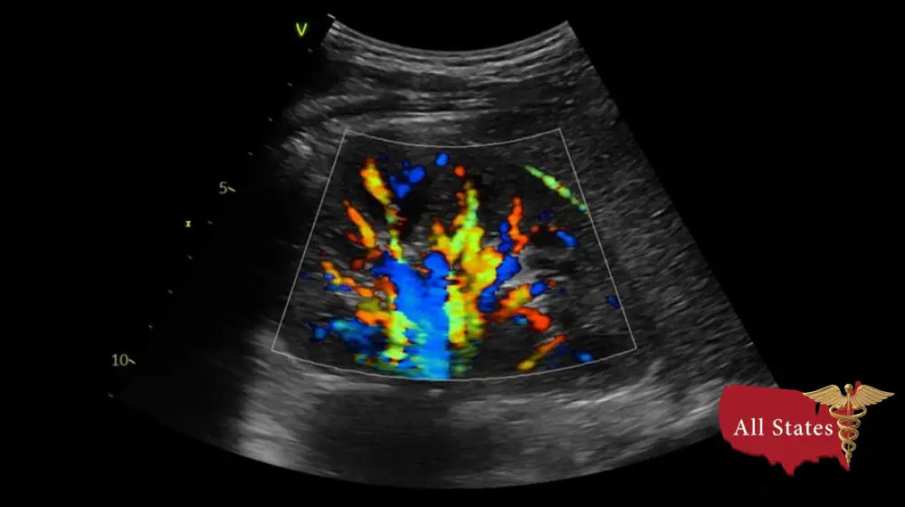 GE Vivid IQ Ultra Edition Portable Ultrasound