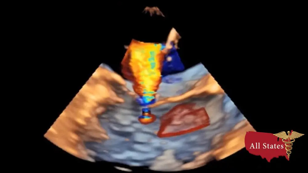 GE Vivid IQ Ultra Edition v206 Portable Ultrasound