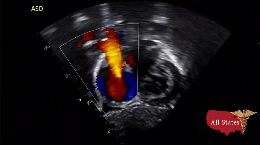 GE Vivid IQ Ultra Edition v206 Portable Ultrasound