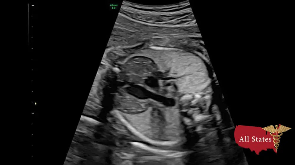 GE VOLUSON E8 Refurbished WITH 3 Probes