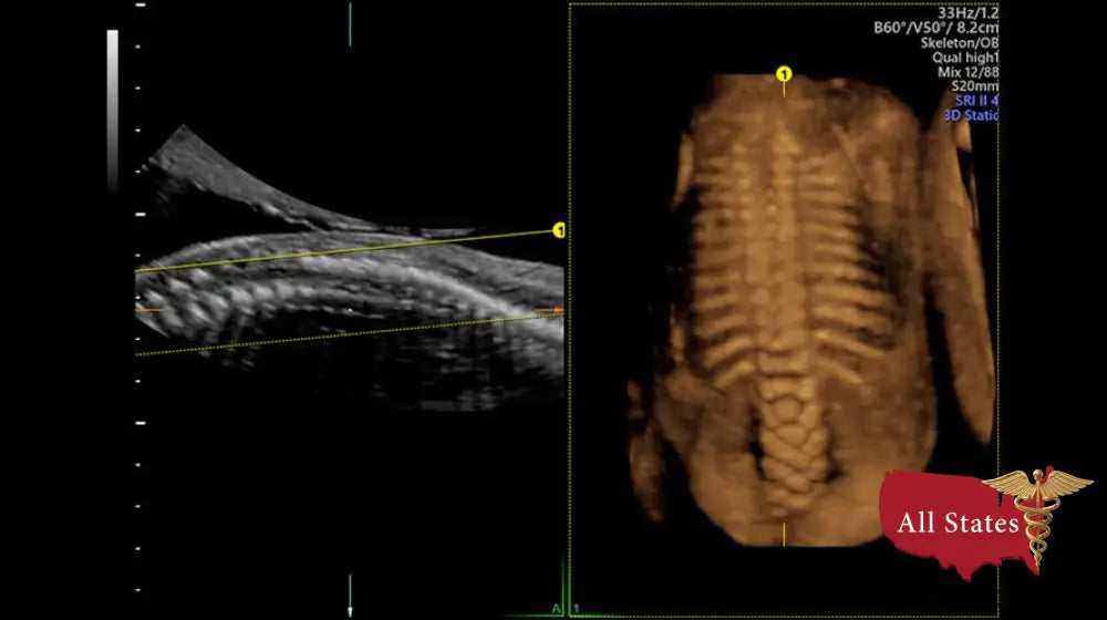 GE VOLUSON P8 BT16 Refurbished WITH 3 Probes