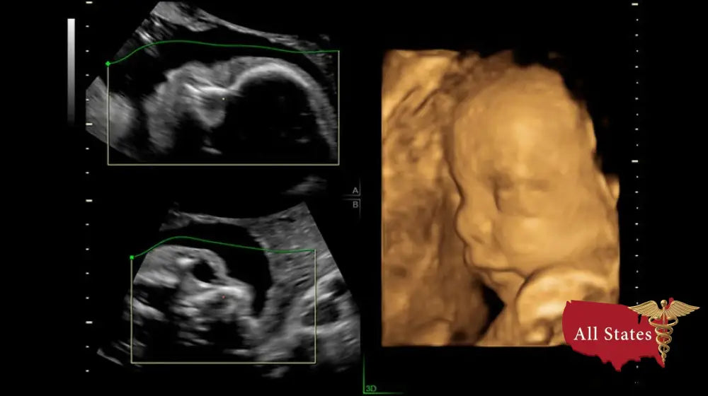 GE VOLUSON P8 BT22 Brand New