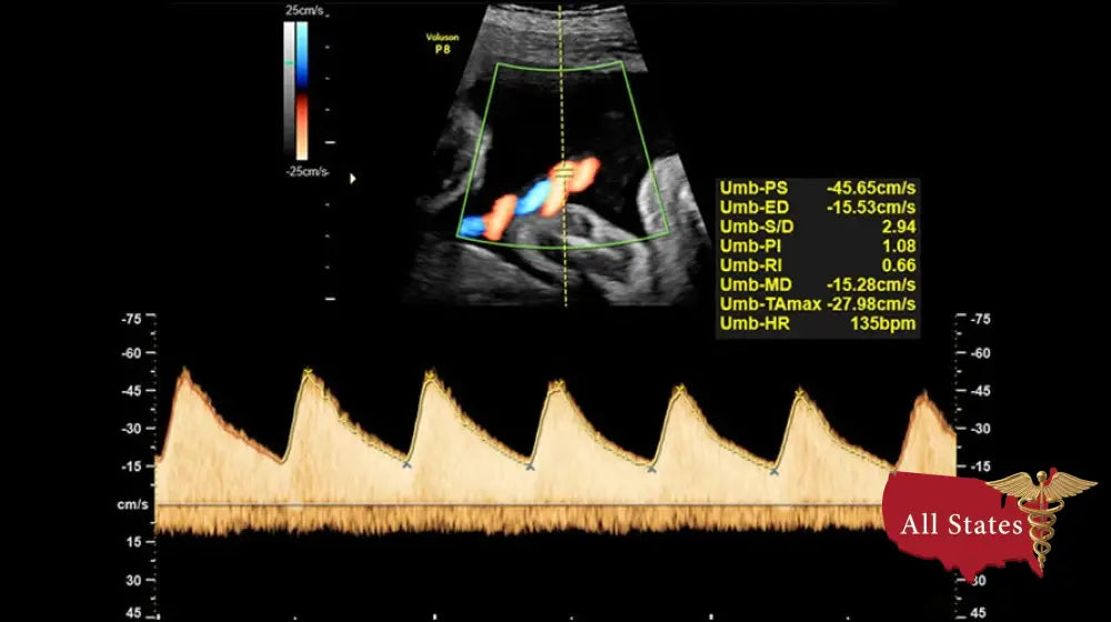 GE VOLUSON P8 BT22 Brand New